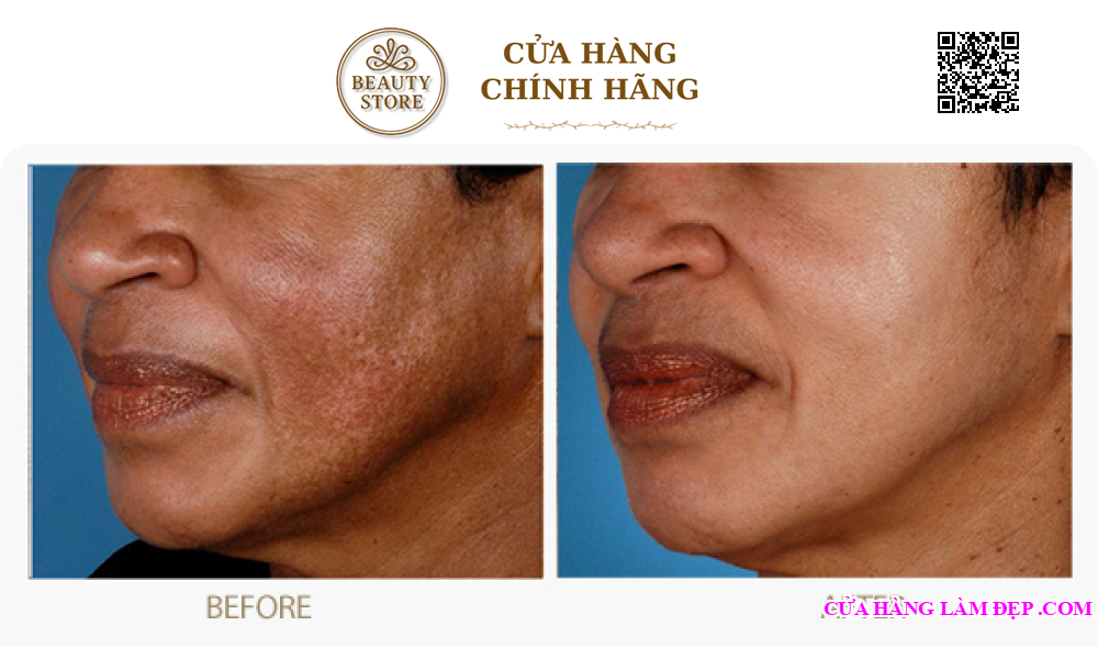 Kem đặc Mờ Nám ZO Melamin Skin Bleaching Crème