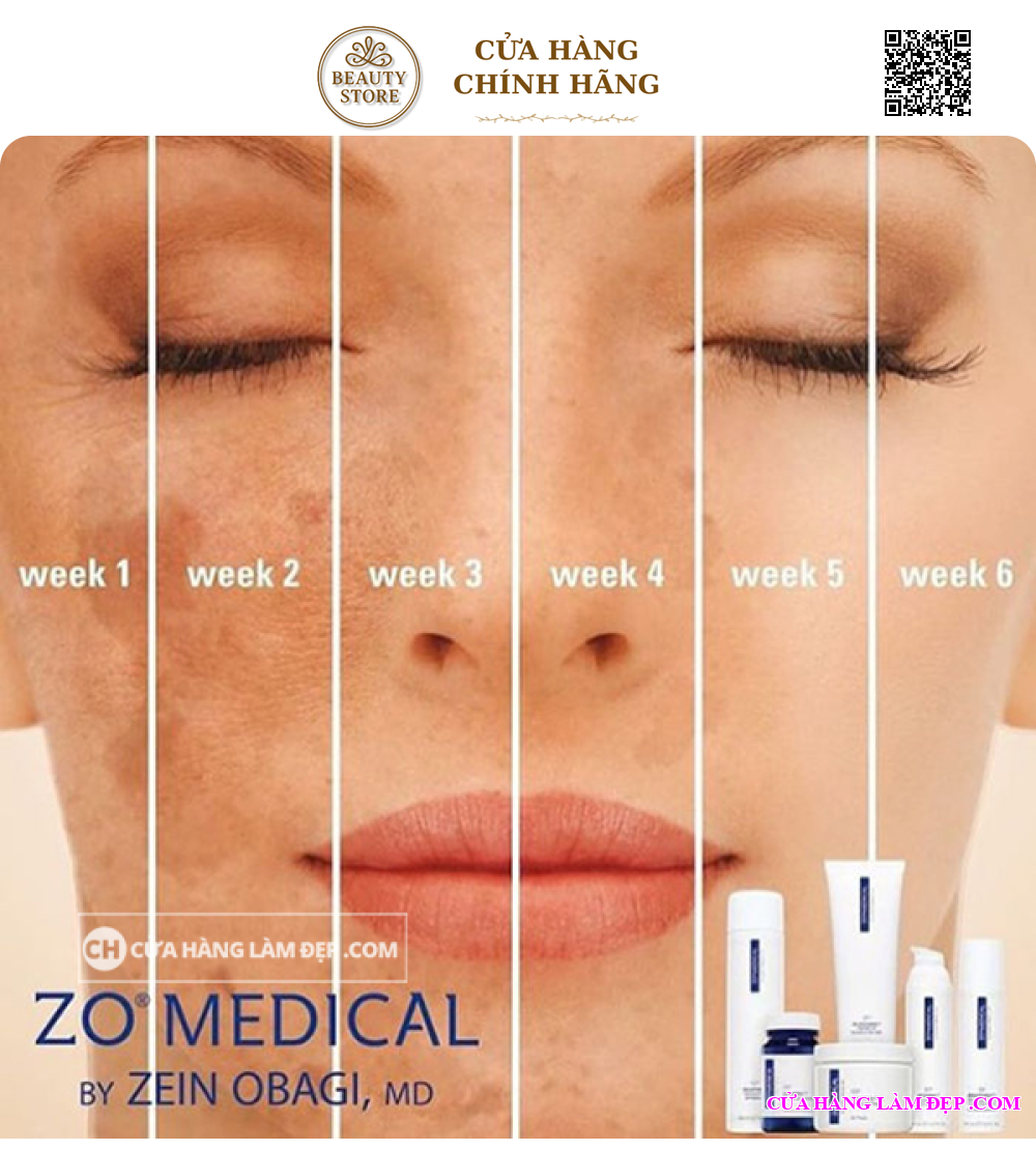 Kem Dưỡng Sáng, Tái Tạo Da ZO Brightenex Skin Britener and Correcting Cream