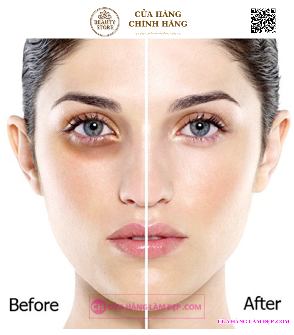 Kem Dưỡng, Điều giảm Nếp Nhăn, Quầng Thâm Và Bọng Mắt Thalgo Silicium Eye Cream