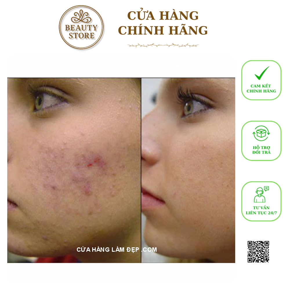 Kem Giảm Mụn Obagi Cream USP 0.1%