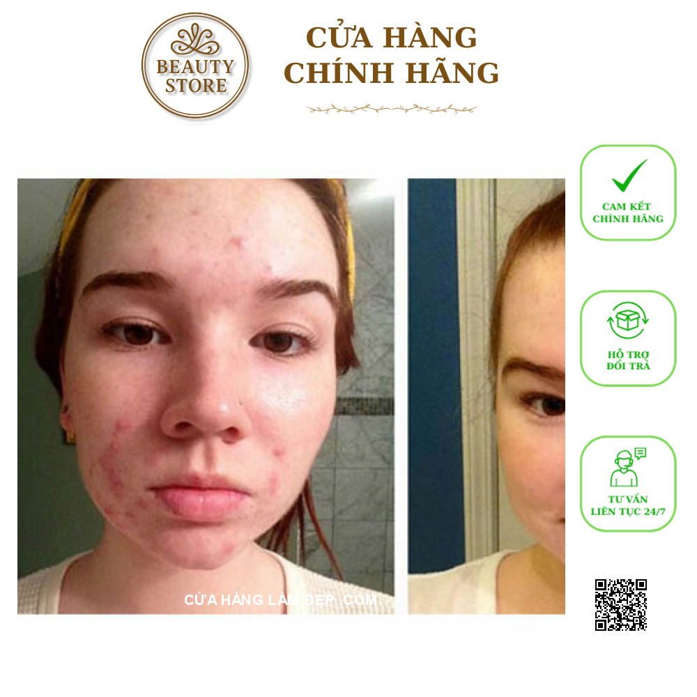 Kem Giảm Mụn, Làm Sáng Da Obagi T.R.E Cream USP 0.05%