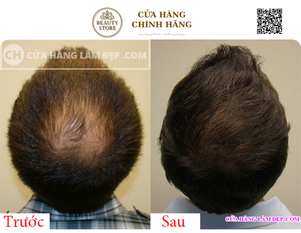 Tinh Chất Kích Thích Mọc Tóc Thảo Dược AROVICS Nhật Bản