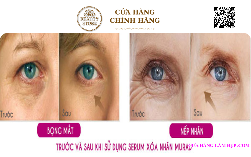 Serum Nâng Cơ Và Xoá Nhăn Vùng Mắt Murad Intensive Wrinkle Reducer® For Eyes