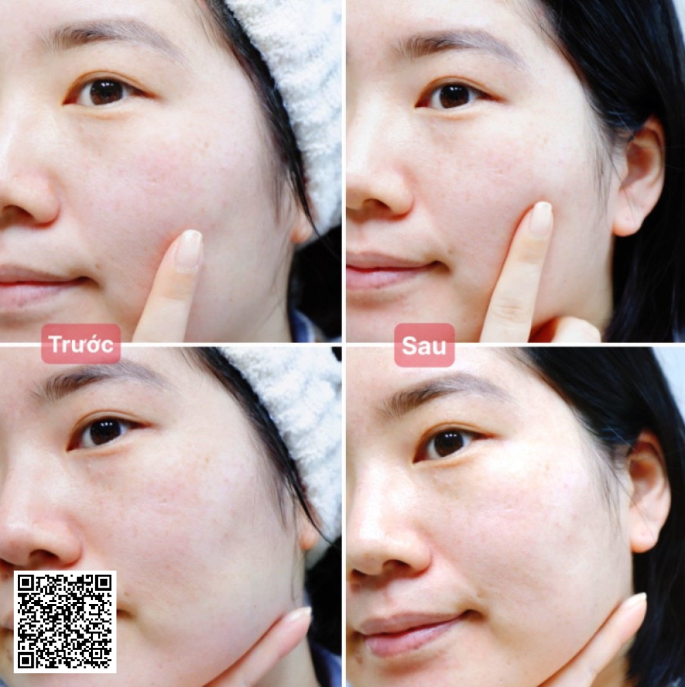 Gel Rửa Mặt JeuDemeure Clearcell Oil-like Cleansing Gel 2in1 Từ Hàn Quốc 250ml