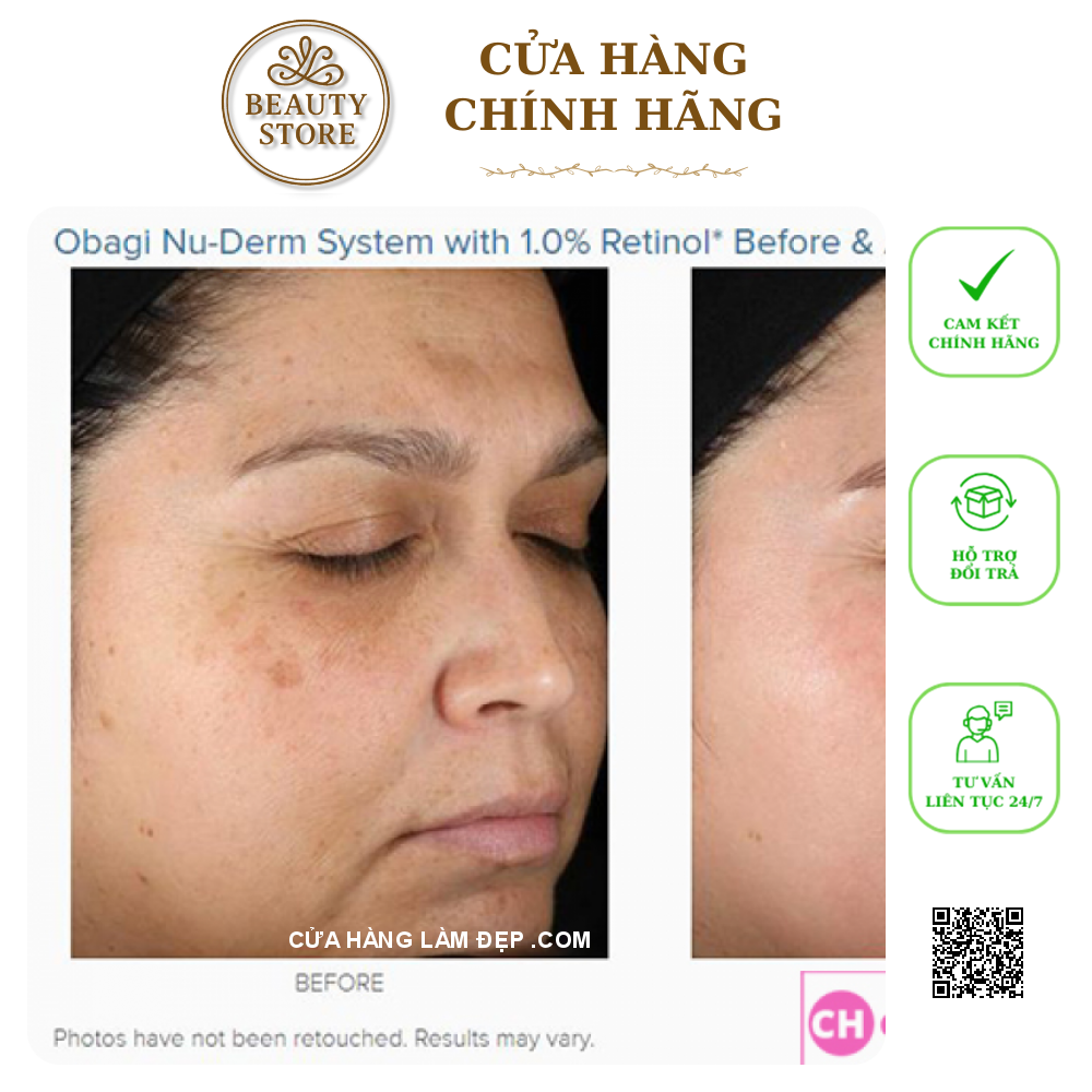 Kem dưỡng da trẻ hóa, ngừa mụn, cân bằng sắc tố da Obagi 360 Retinol 1.0%