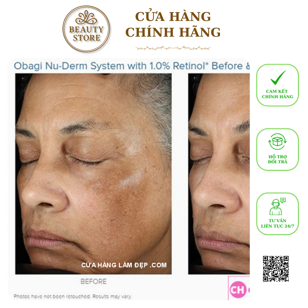 Kem dưỡng da trẻ hóa, ngừa mụn, cân bằng sắc tố da Obagi 360 Retinol 1.0%