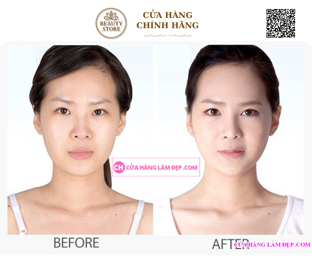 Kem Dưỡng Ẩm, Hỗ Trợ Ngừa Lão Hóa Obagi Gentle Rejuvenation Skin Calming Cream